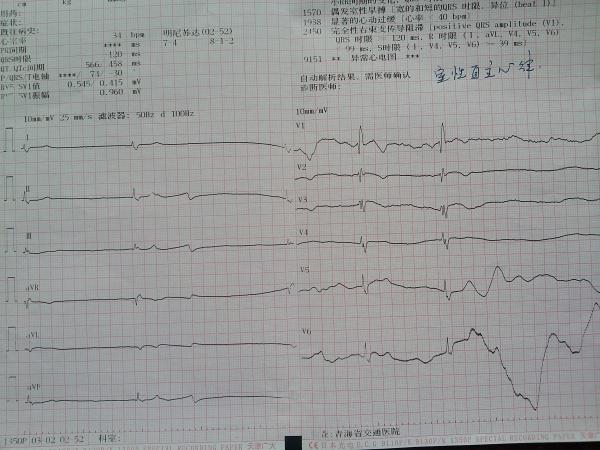 临终前图 - 心电图脑电图专业讨论版 - 爱爱医医学