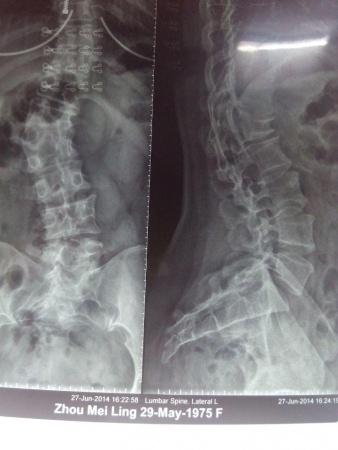 请教骨折部位 - 医学影像学讨论版 - 爱爱医医学论坛