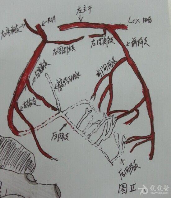 "课堂】【一张图医学】【第八讲】【原创大作】一张图示冠脉分支