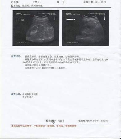 7月9日开始疼痛,双肾结石,右输尿管上段结石隐痛至今