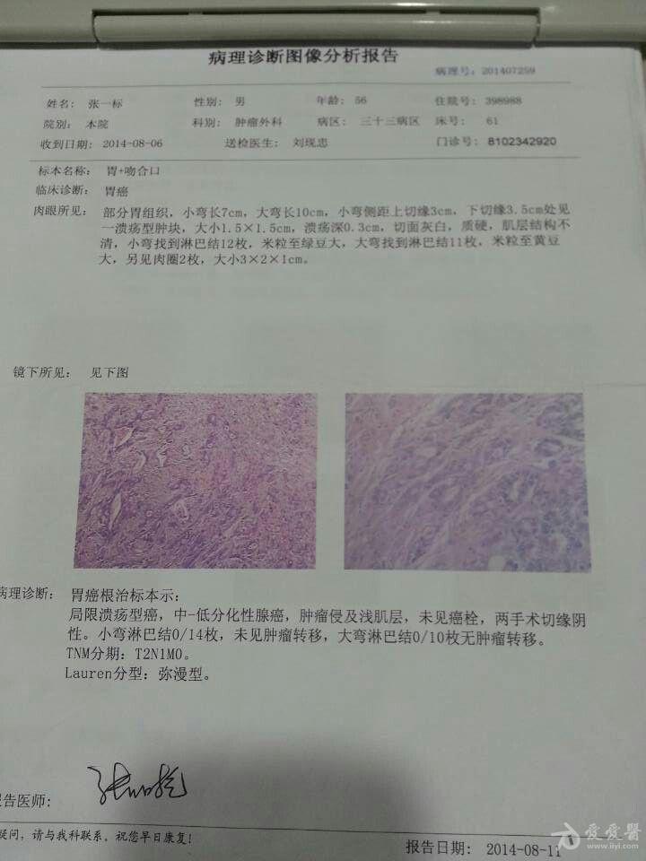 8月6日行胃癌根治术,术后病理看报告?