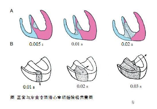 表现为qrs 升支的起始部位圆钝