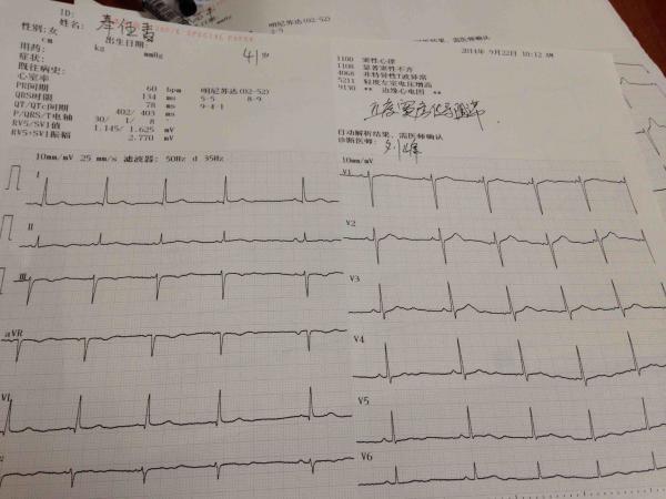 窦房阻滞 心电图脑电图专业讨论版 爱爱医医学论坛 爱爱医医学