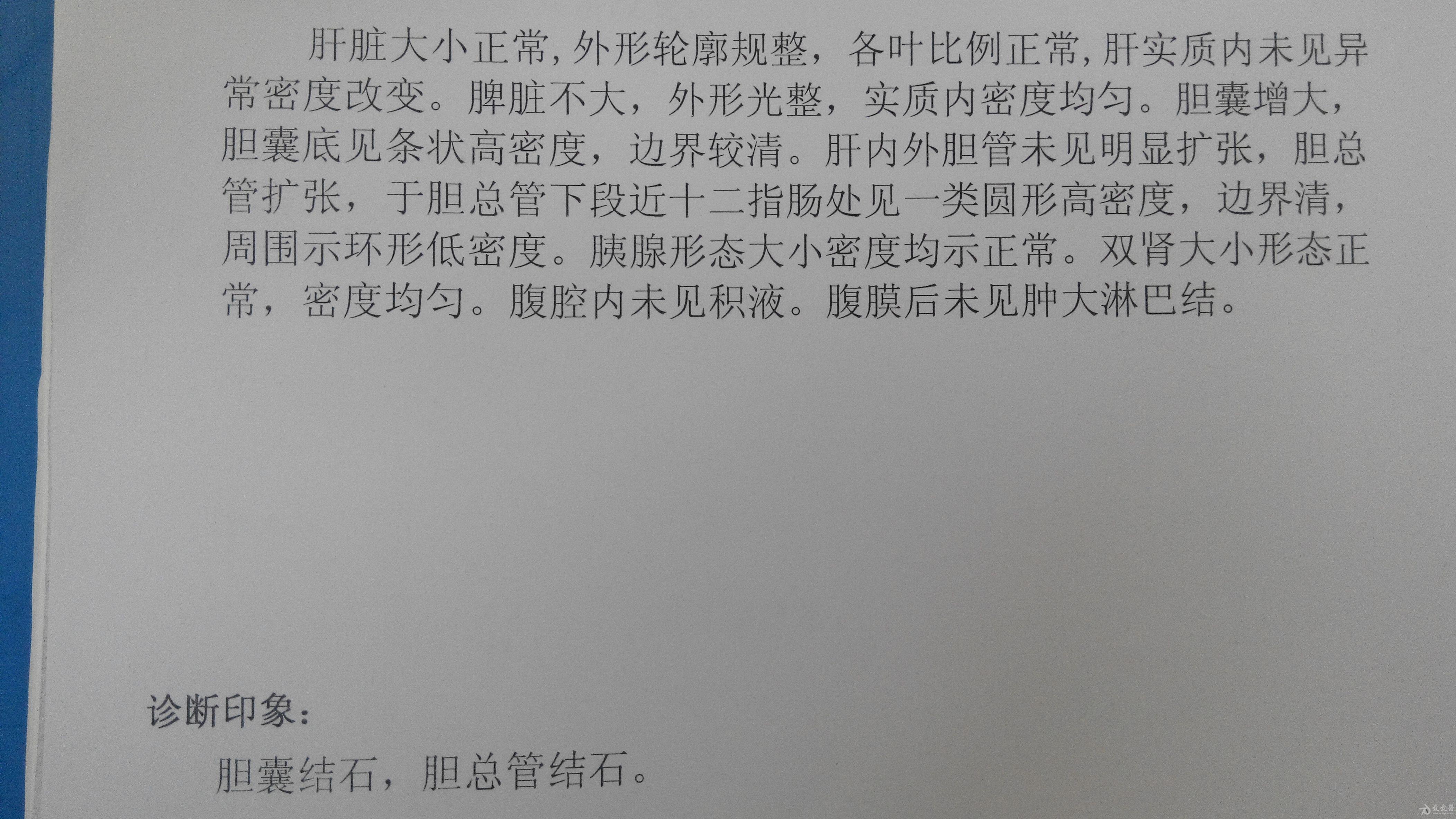 胆囊结石并胆总管结石一例