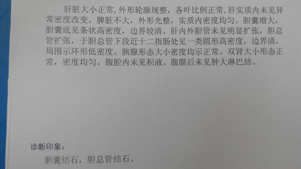 胆囊结石并胆总管结石一例