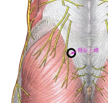 髂后上棘处疼痛可触及条索状物求治疗方案