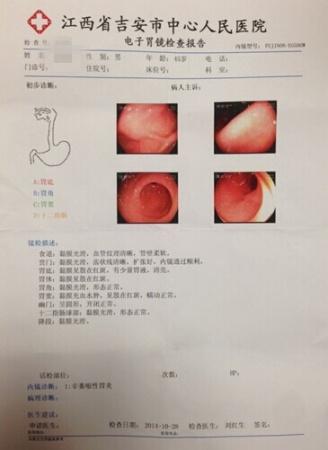 亲历胃肠镜检查