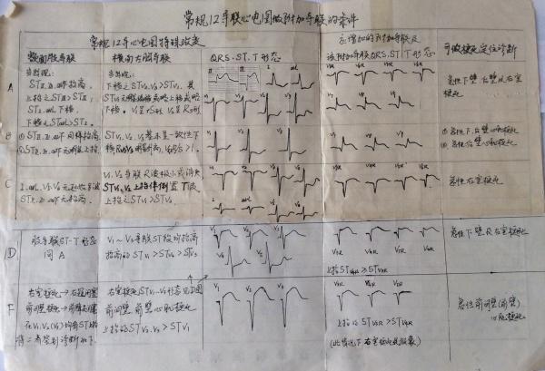 怎样辨别12导联情况下急性右室梗死的迹象 - 心电图脑