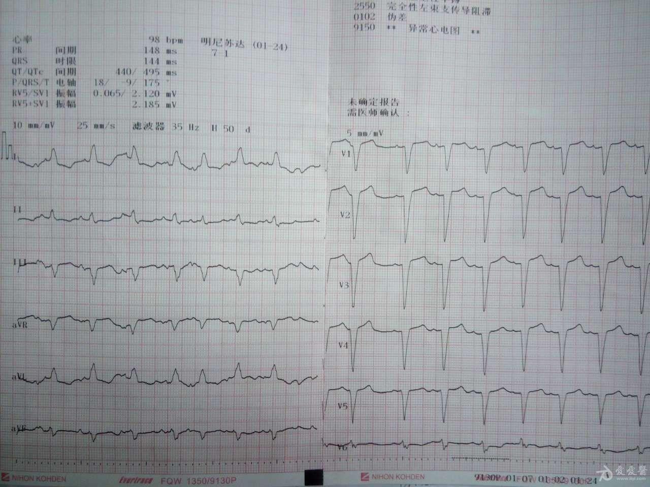 求该心电图诊断