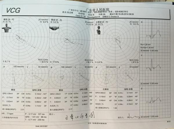 楼主zhang154152014-12-16 20:00:55       这是医院做的心电图,心脏