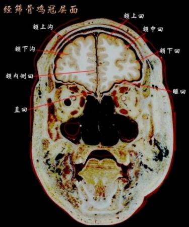 神经系统资料 - 神经内科讨论版 - 爱爱医医学论