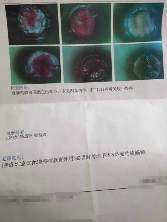 教学病例20——外痔一例