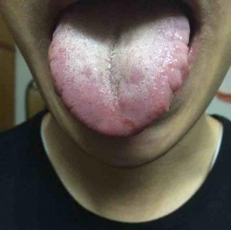 看舌诊病