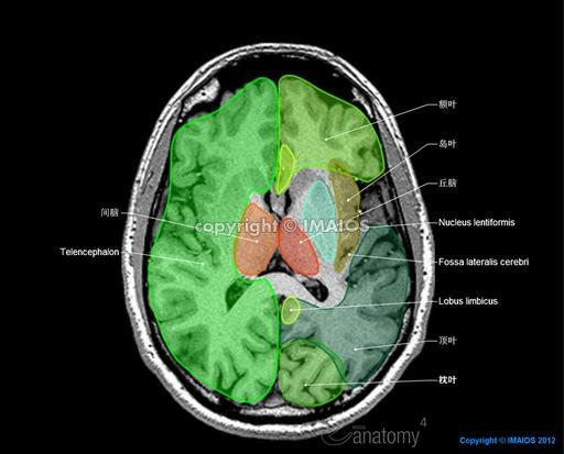 颅脑解剖图谱 - 神经内科讨论版 - 爱爱医医学论