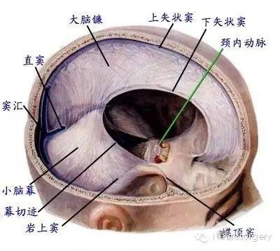 硬脑膜静脉窦的解剖