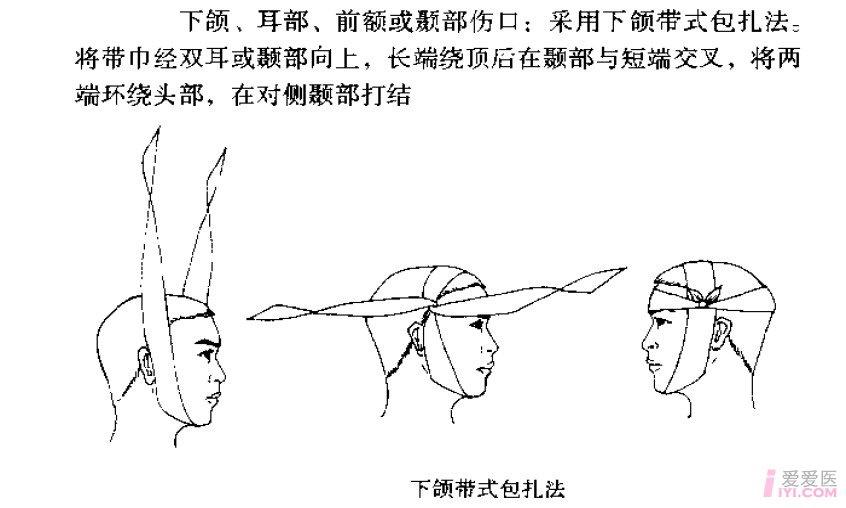 求助三角巾下颌包扎视频