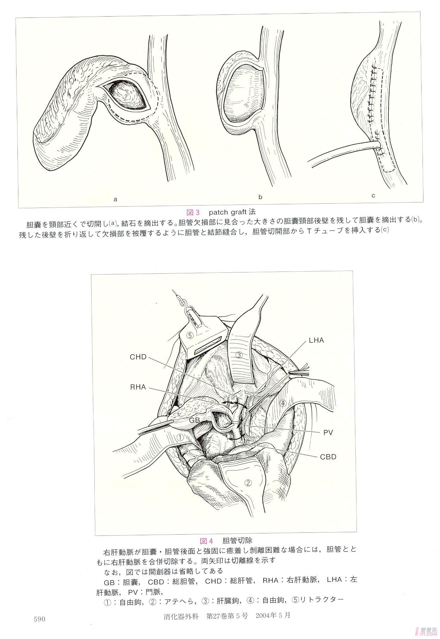 资源日本期刊中lc术的精美图片