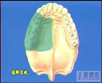 贴图资源腭大孔麻醉图解