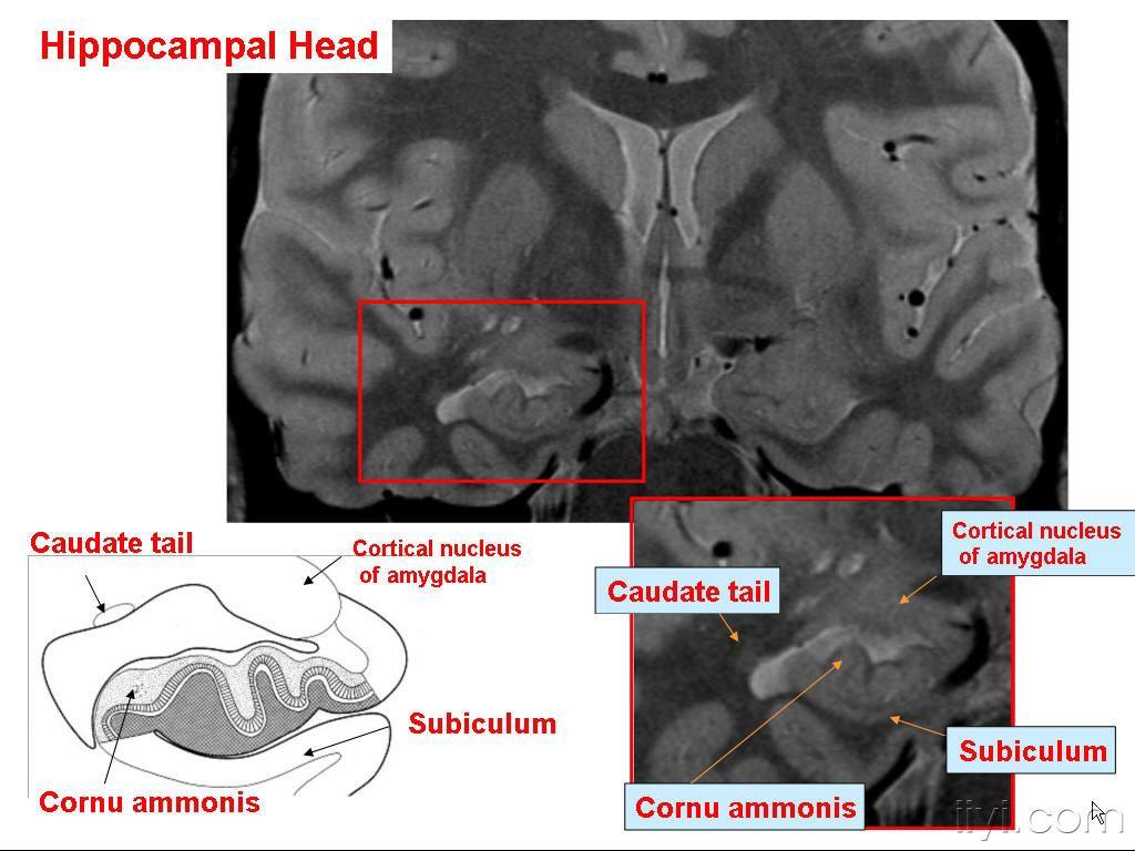 海马解剖与相关结构