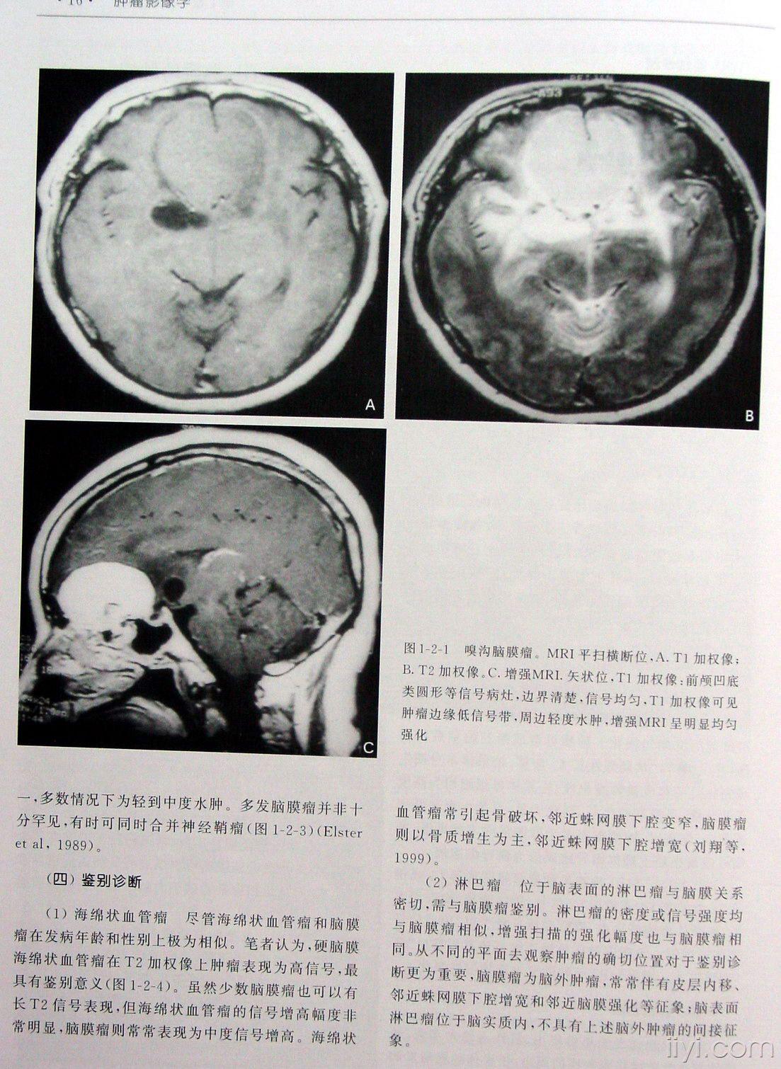 肿瘤影像学中枢神经系统肿瘤附件为图片不用费币下载