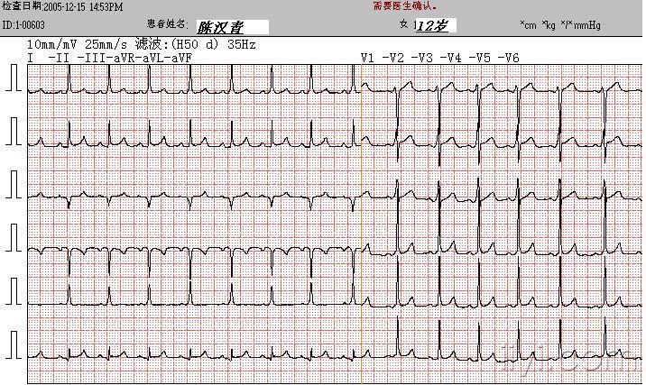 心动过速讨论图