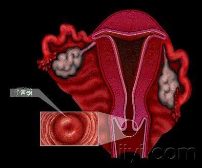 子宫卵巢3d示意图.jpg