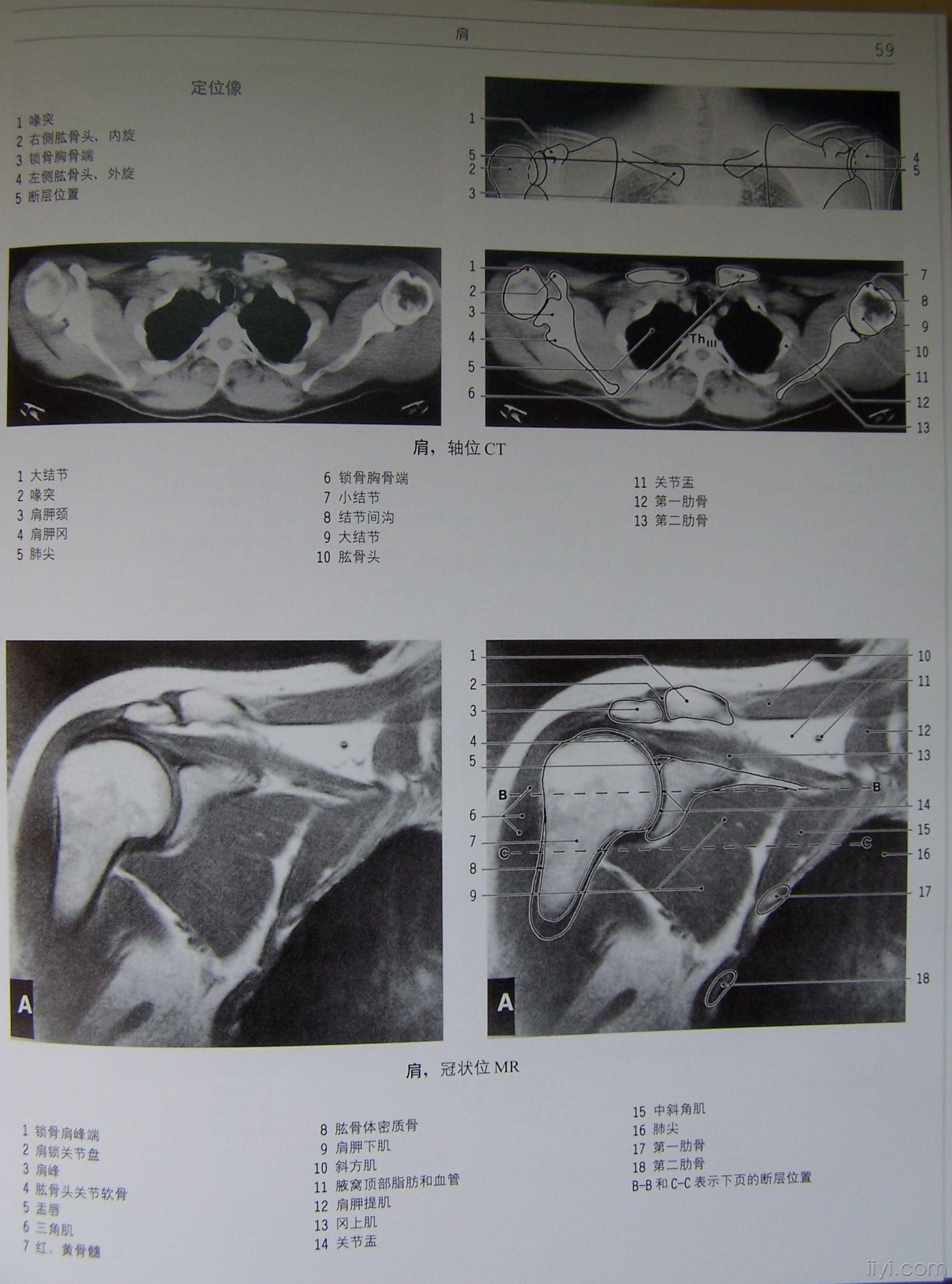 正常肩关节mri