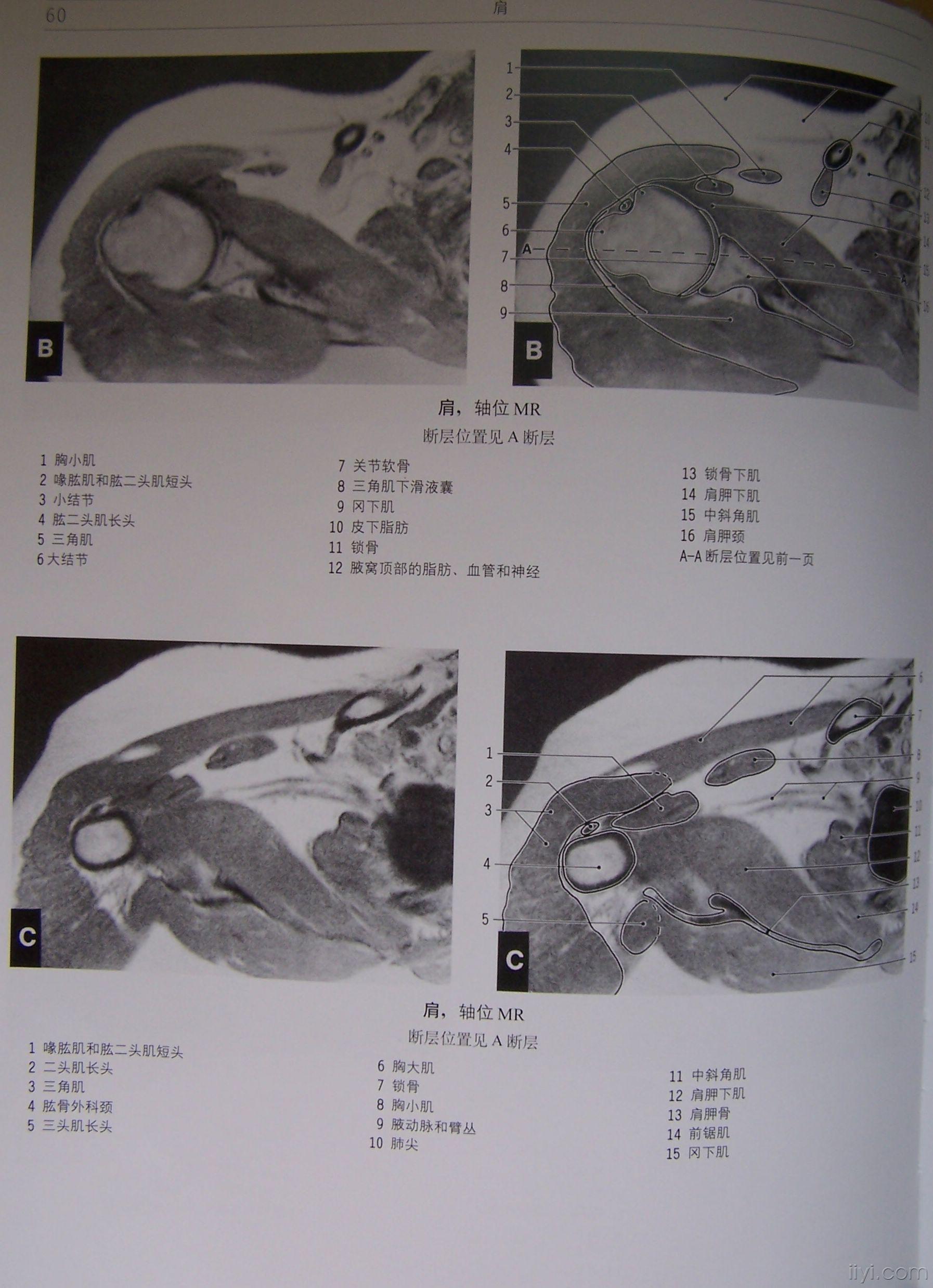 正常肩关节mri