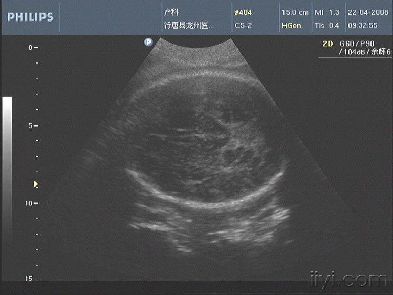 超声医学讨论版 爱爱医医学论坛