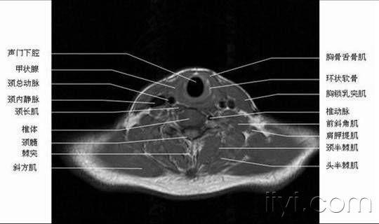 正常喉部示意图