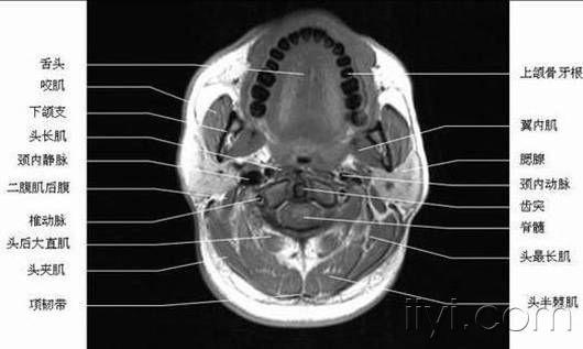 正常喉部示意图