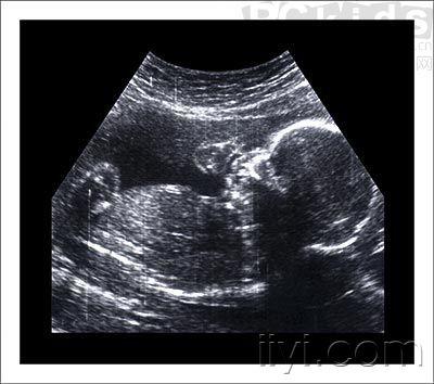 神奇的胎儿图片