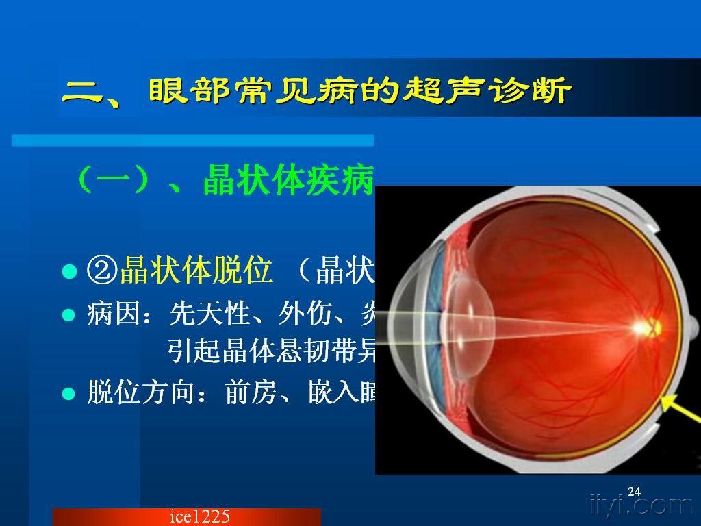 眼部常见病的超声诊断 (幻灯)