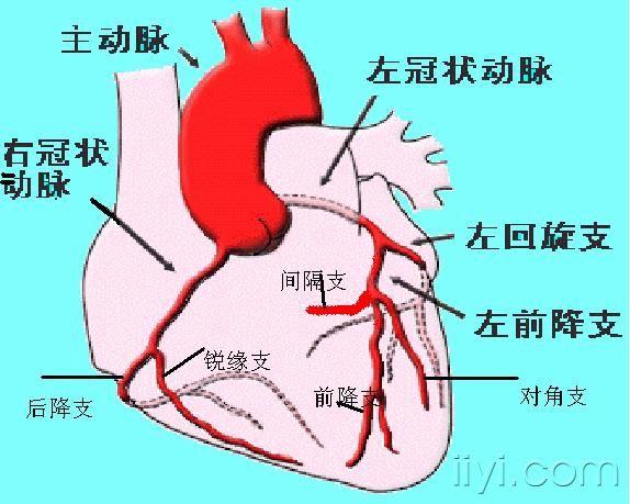 心脏的冠脉供血概述  心脏的血液供应来自左,右冠状动脉.
