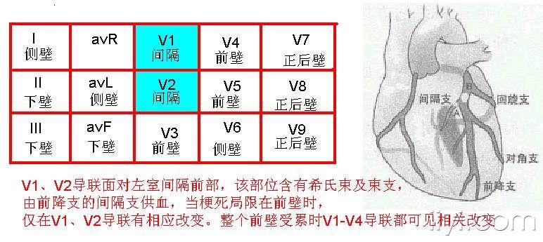 心电图进修--2010.12.11整理