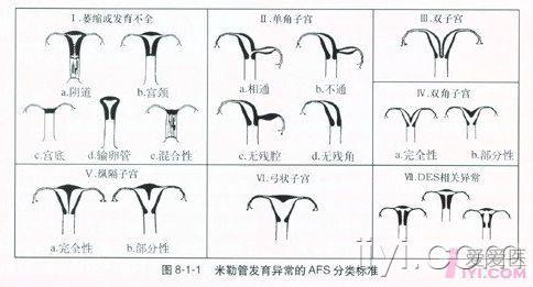 典型的纵隔子宫.