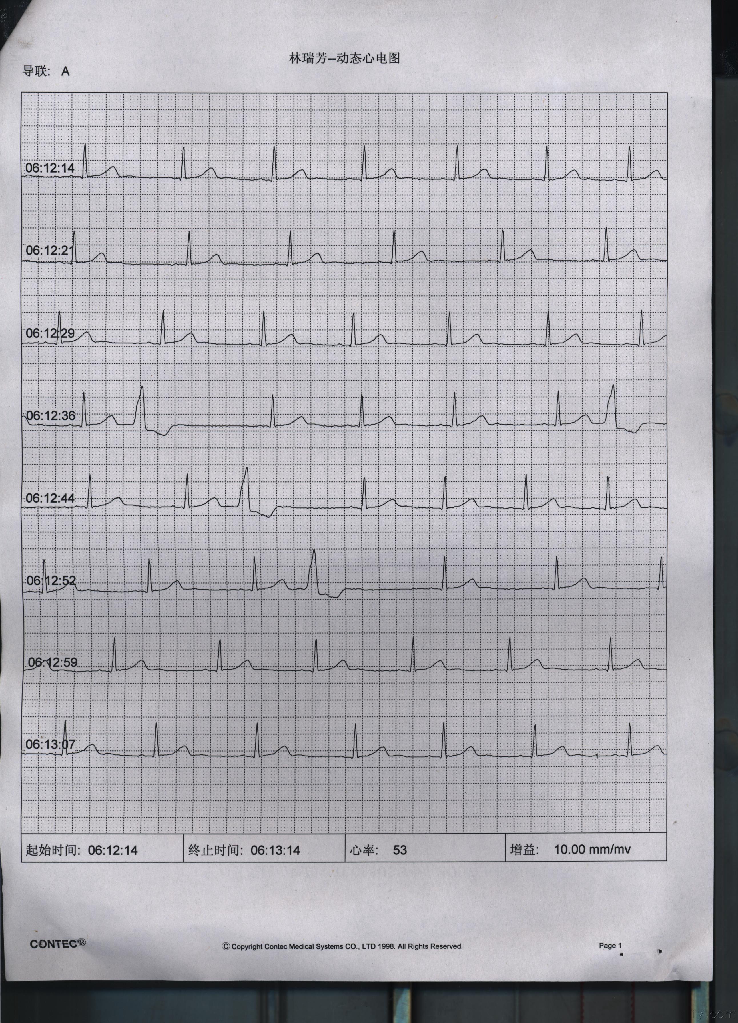 4次24小时动态心电图,请老师分析,谢谢!