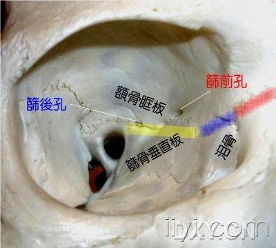 从发一次(筛前动脉结扎)转的 - 耳鼻咽喉-头颈外科版