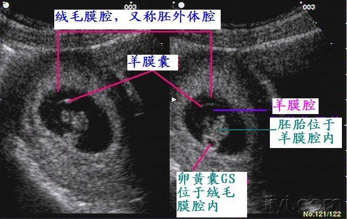 5 羊膜囊 卵黄囊.jpg