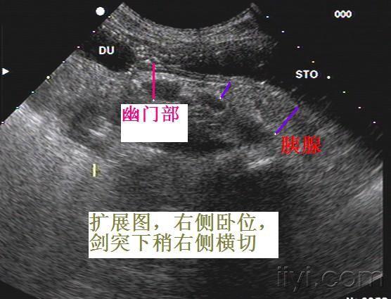 正常胃超声图像(10月8日更正)