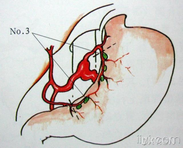 转发胃周的淋巴分布