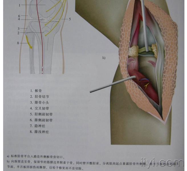 【专题讲座】胫骨平台骨折的外科治疗!