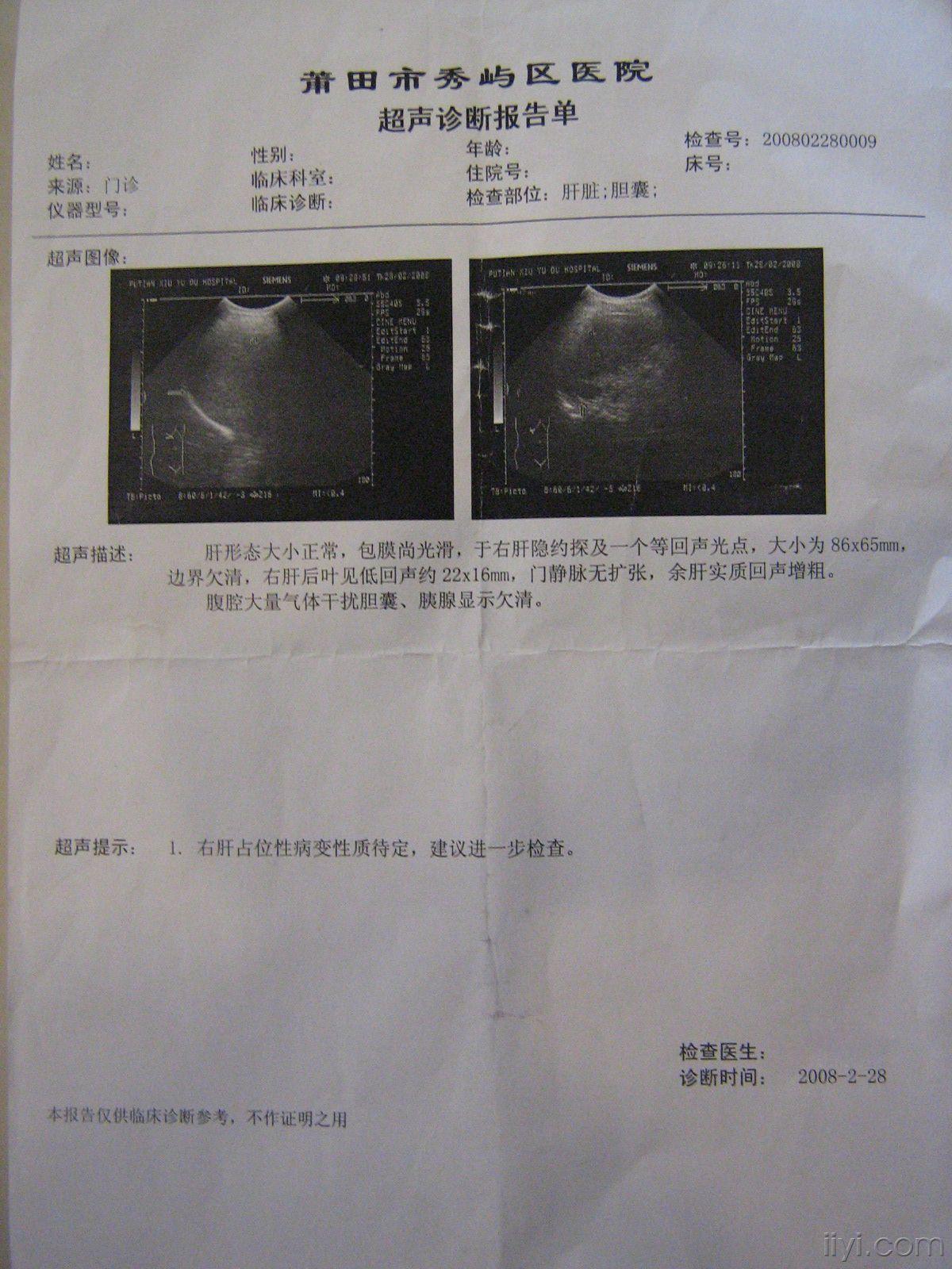 肝癌的ct诊断