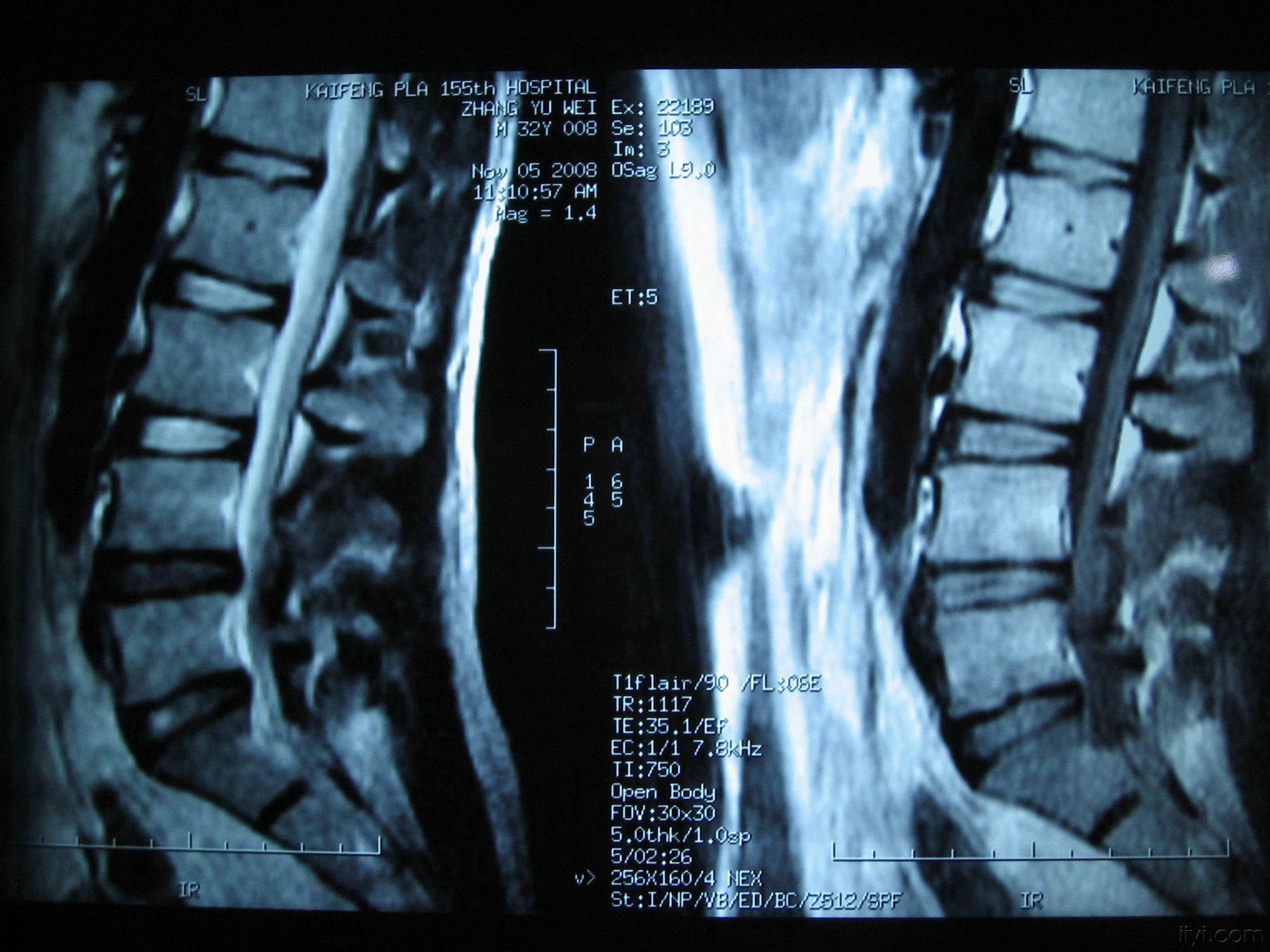 博弈——腰椎间盘突出临床治疗学研究