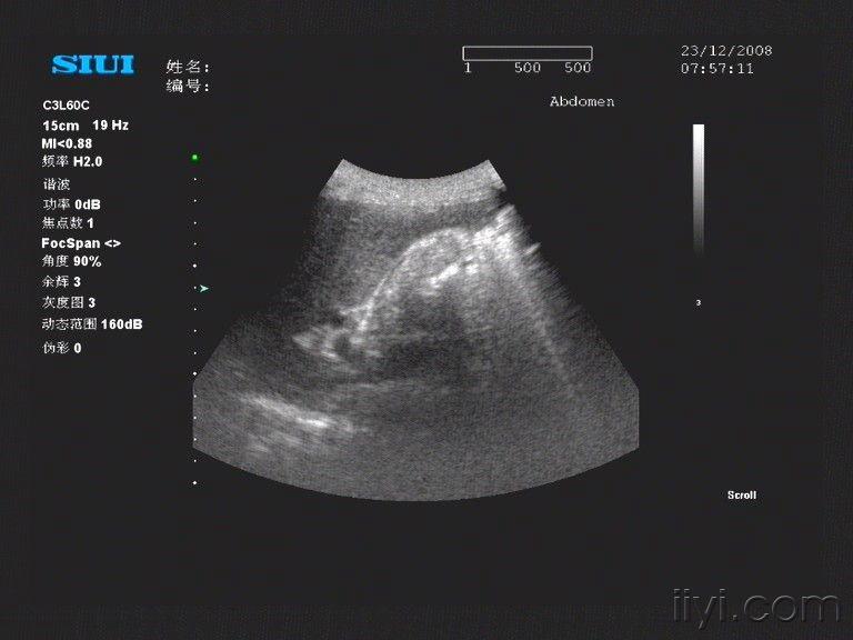 超声医学讨论版 - 爱爱医医学论坛