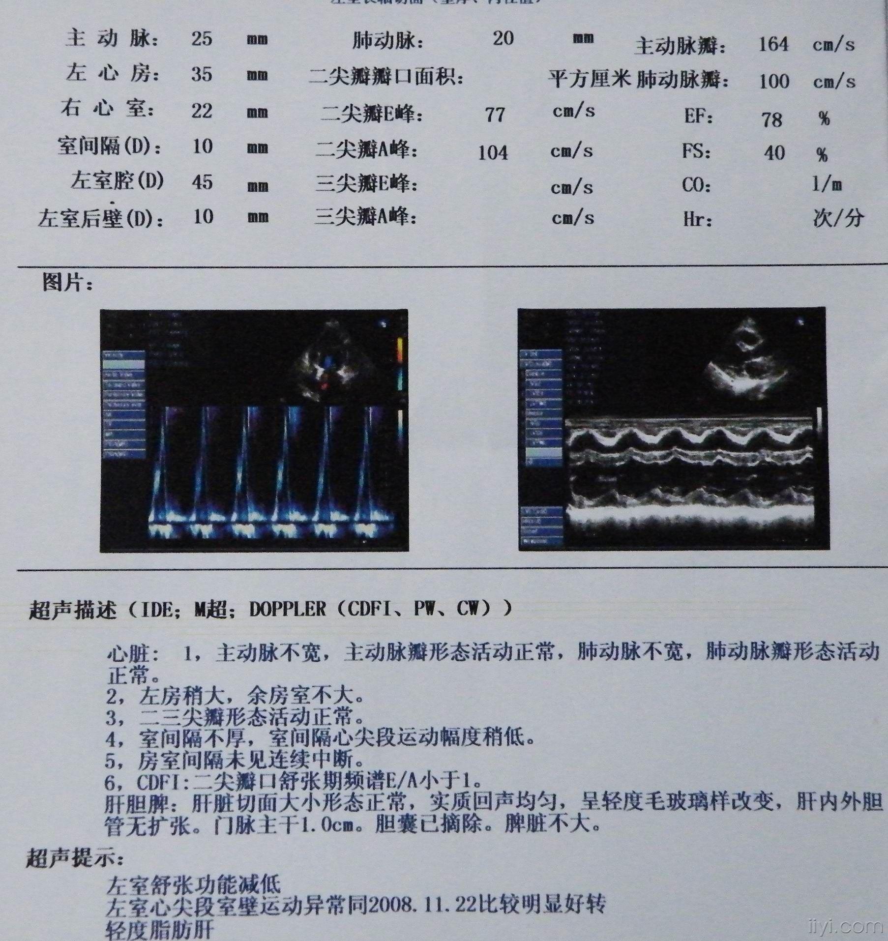 其中一张心脏彩超