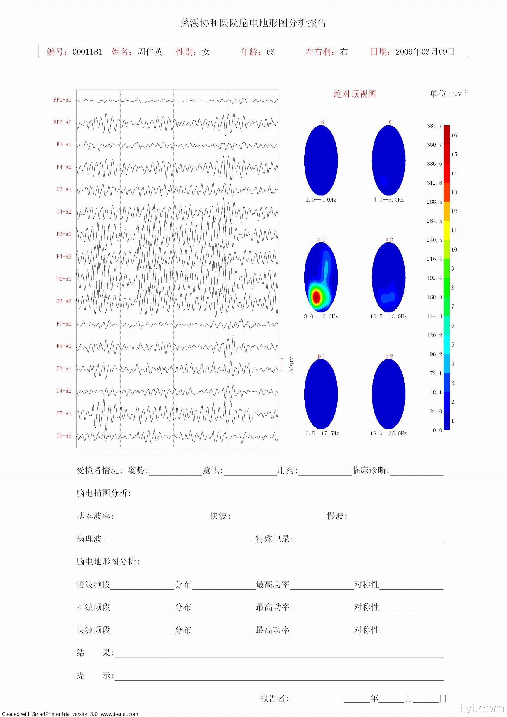 我的脑电图工作日志-09年3月份