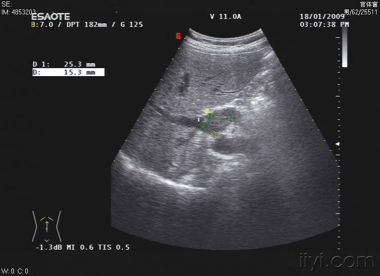超声医学讨论版 - 爱爱医医学论坛