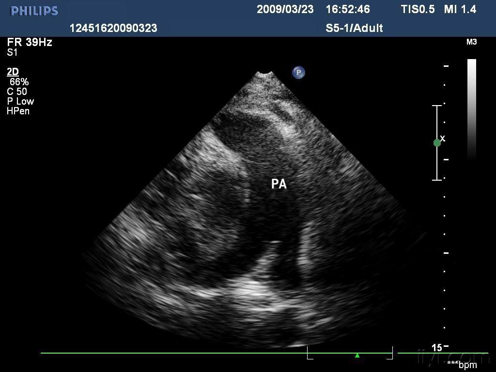 超声医学讨论版 - 爱爱医医学