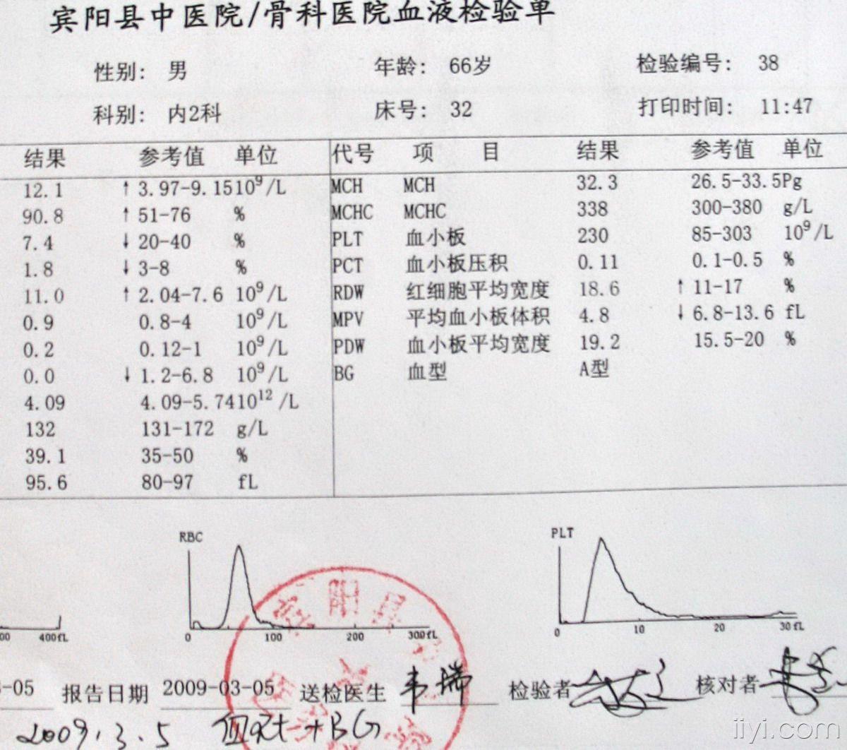 这个病例可以诊断为肝硬化(失代偿期)吗?